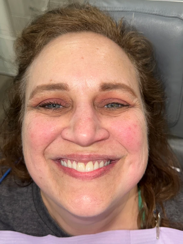 Dental Results Picture