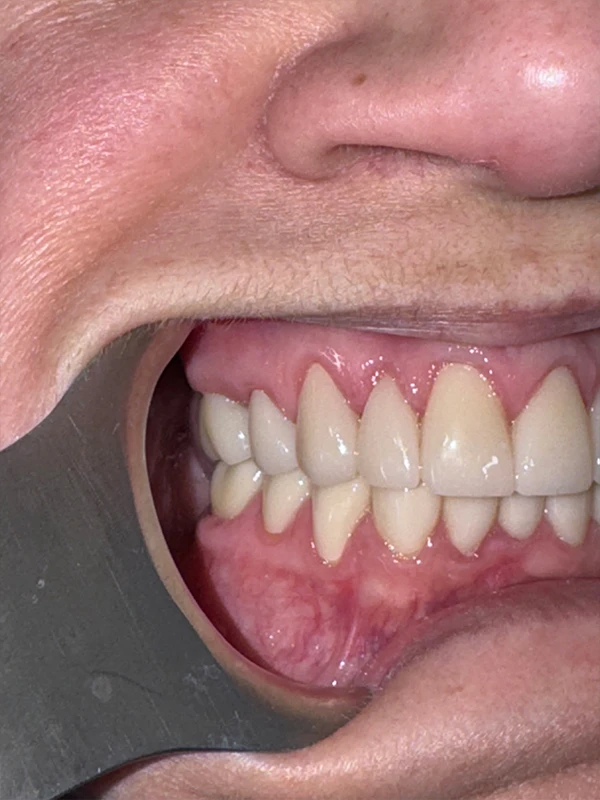 Dental Results Picture