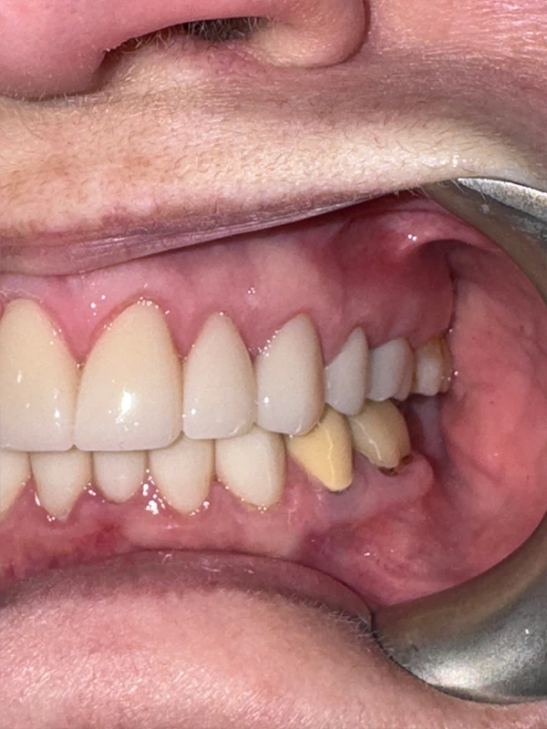 Dental Results Picture