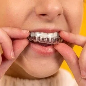 clear dental aligners process in whitehall pa